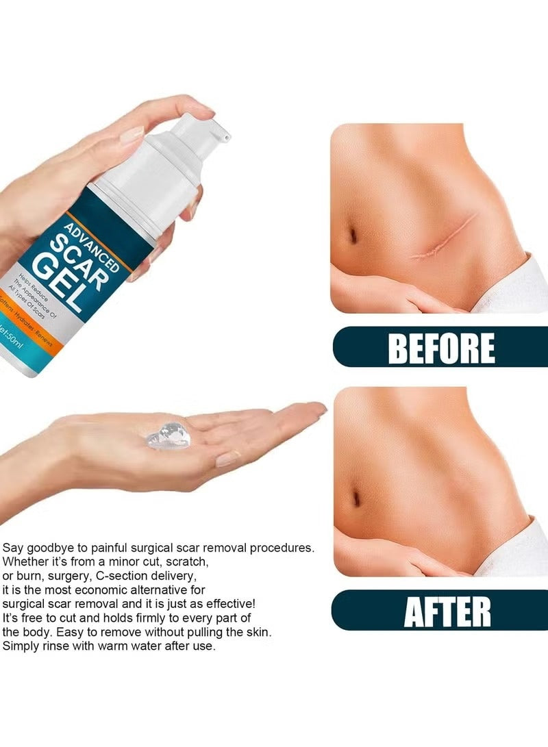 Advance Scar gel  Pack Of 2