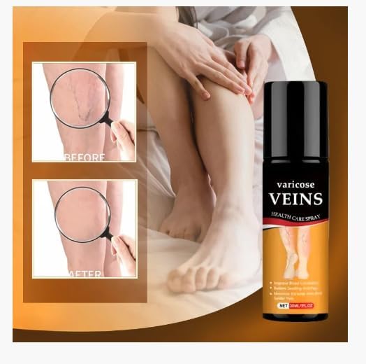 Al Varicose Veins Spray – Natural Herbal Formula for Fast Relief | Reduces Swelling, Relieves Pain & Promotes Blood Circulation | Easy-to-Use Spray for Legs, Ankles & Feet  buy 1 get 1 free