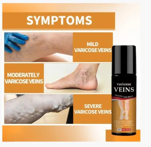 Al Varicose Veins Spray – Natural Herbal Formula for Fast Relief | Reduces Swelling, Relieves Pain & Promotes Blood Circulation | Easy-to-Use Spray for Legs, Ankles & Feet  buy 1 get 1 free