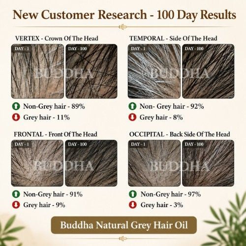 Anti Grey Hair Oil - 100% Ayush Certified - For Premature Greying, Restore Natural Hair Color (BUY1GET1FREE)