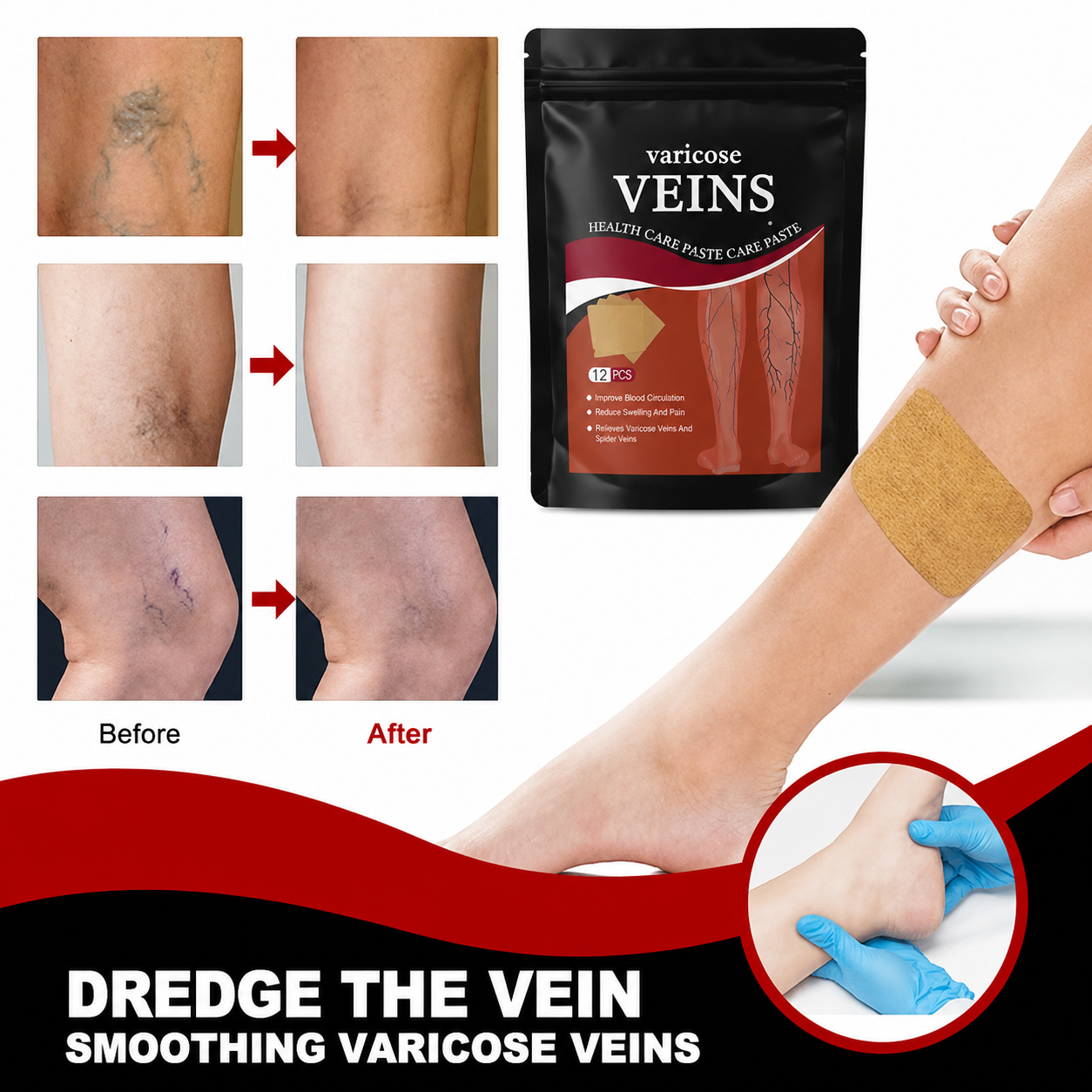Varicose Veins Relief Patches – 12 PCS | Reduces Swelling, Relieves Pain, Improves Blood Circulation & Vein Health | Herbal, Skin-Friendly & Instant Pain Relief